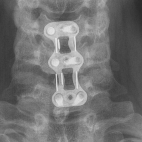 Meet your Posher, Allison - Picture 3 of 3